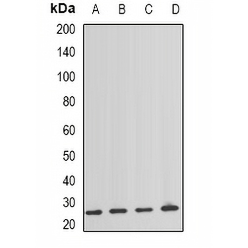 NAT8 Rabbit Polyclonal Antibody