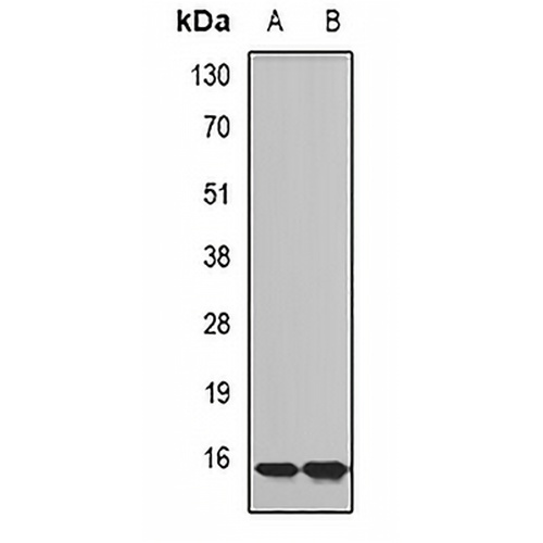 Complexin-2 Rabbit Polyclonal Antibody