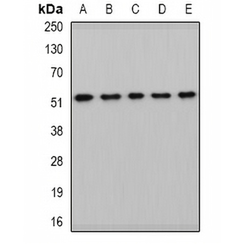 HARS2 Rabbit Polyclonal Antibody