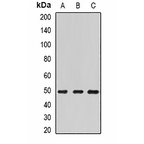 ECSIT Rabbit Polyclonal Antibody