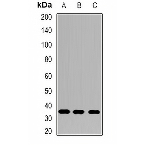 AKR1B10 Rabbit Polyclonal Antibody