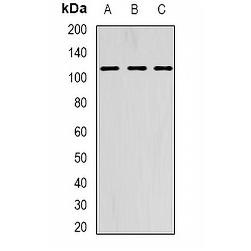 AARS2 Rabbit Polyclonal Antibody