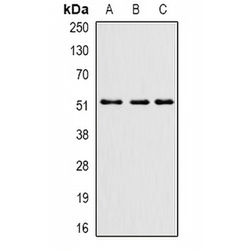 PHF21B Rabbit Polyclonal Antibody