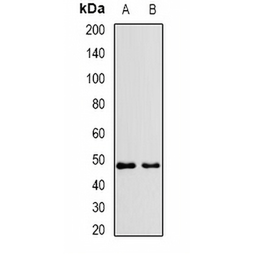 VPS37A Rabbit Polyclonal Antibody