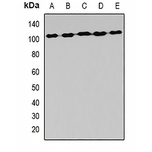 AlaRS Rabbit Polyclonal Antibody
