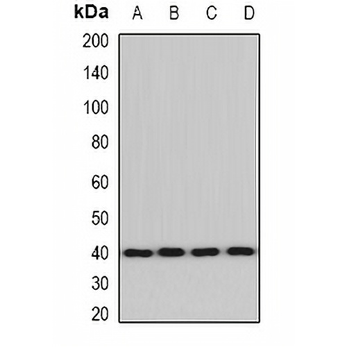 ACAT2 Rabbit Polyclonal Antibody