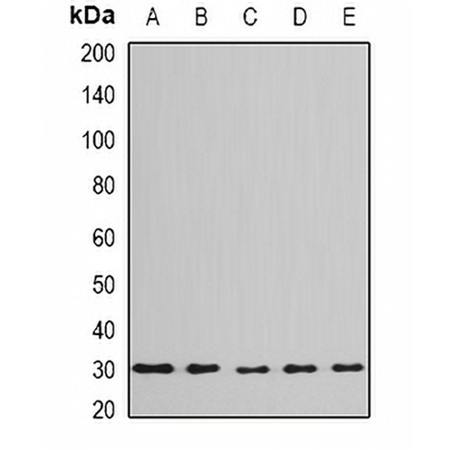 BPGM Rabbit Polyclonal Antibody
