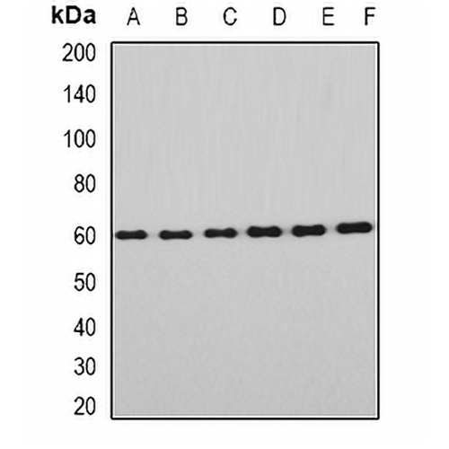 EYA3 Rabbit Polyclonal Antibody