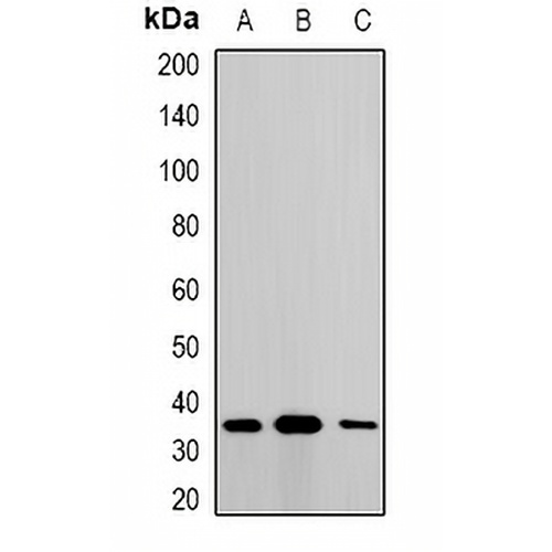Metaxin-1 Rabbit Polyclonal Antibody