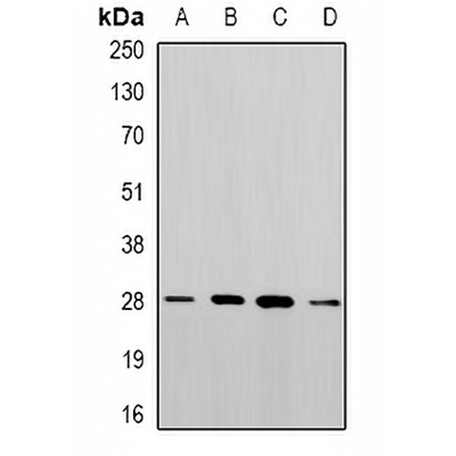 PGAM2 Rabbit Polyclonal Antibody