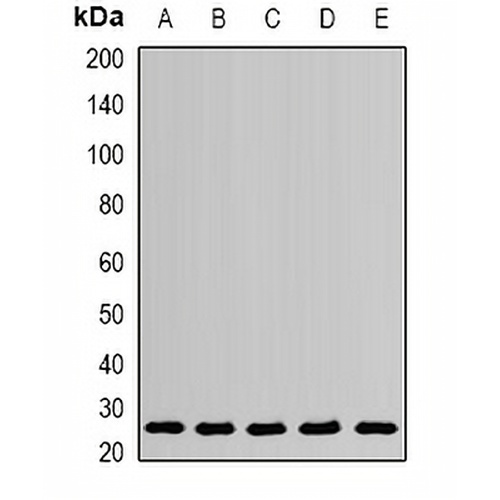 PSPH Rabbit Polyclonal Antibody