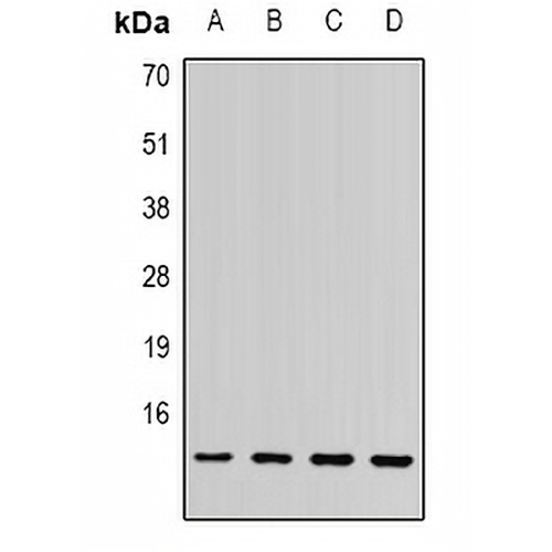 SSNA1 Rabbit Polyclonal Antibody