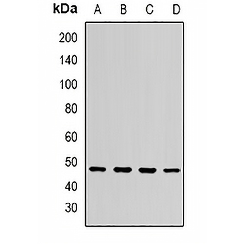 ST3GAL5 Rabbit Polyclonal Antibody