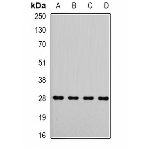 Metaxin-2 Rabbit Polyclonal Antibody