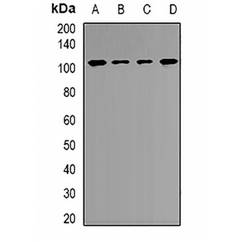 MTHFD1L Rabbit Polyclonal Antibody
