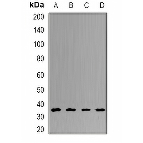 UCH-L5 Rabbit Polyclonal Antibody