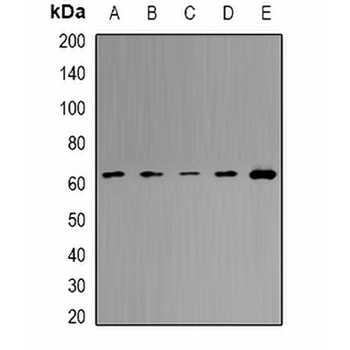 MCCB Rabbit Polyclonal Antibody