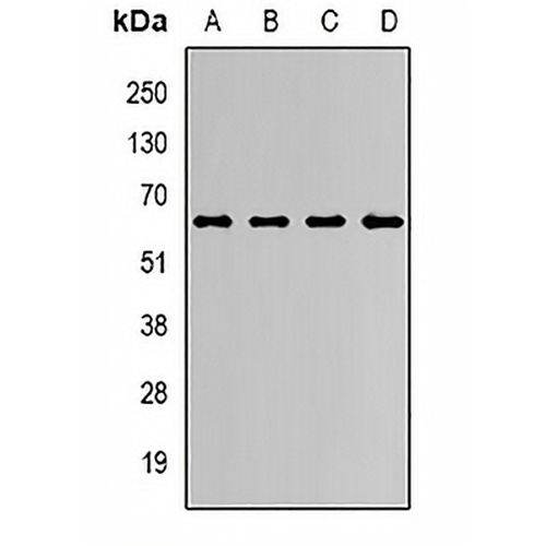 JMJD4 Rabbit Polyclonal Antibody