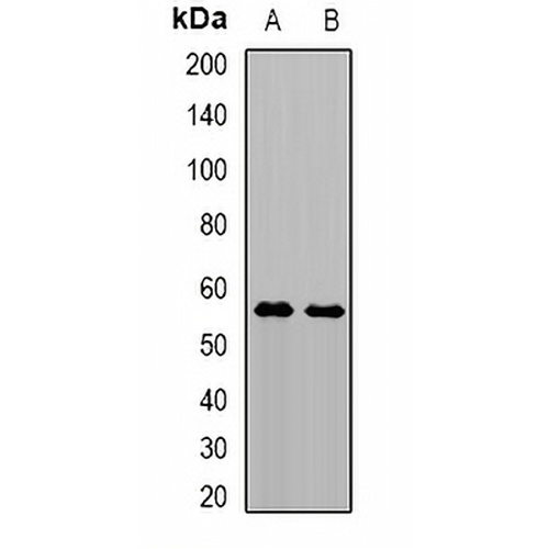 TRMT61B Rabbit Polyclonal Antibody