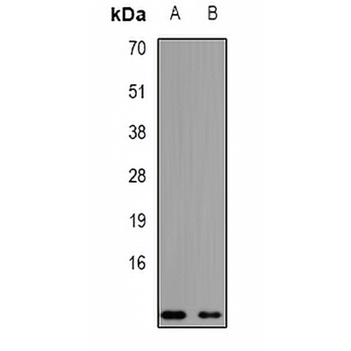 NDUFA2 Rabbit Polyclonal Antibody