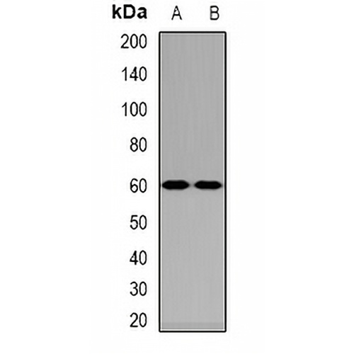 NPR-C Rabbit Polyclonal Antibody