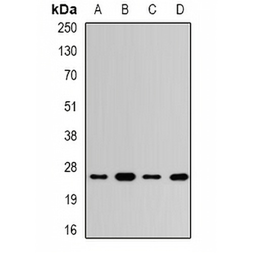 UCH-L3 Rabbit Polyclonal Antibody