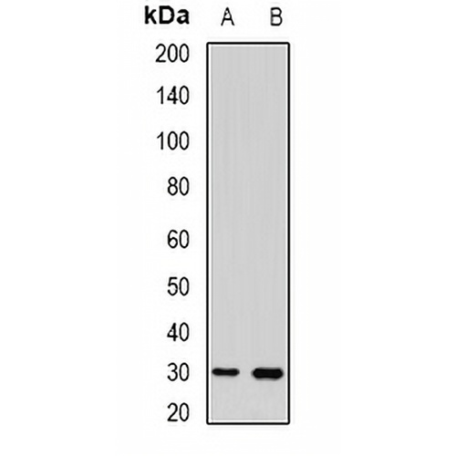 UPIb Rabbit Polyclonal Antibody