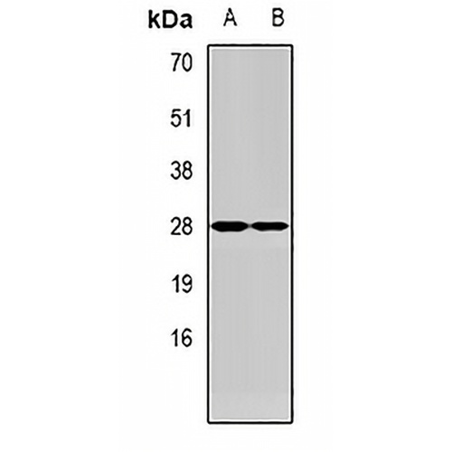 Med6 Rabbit Polyclonal Antibody