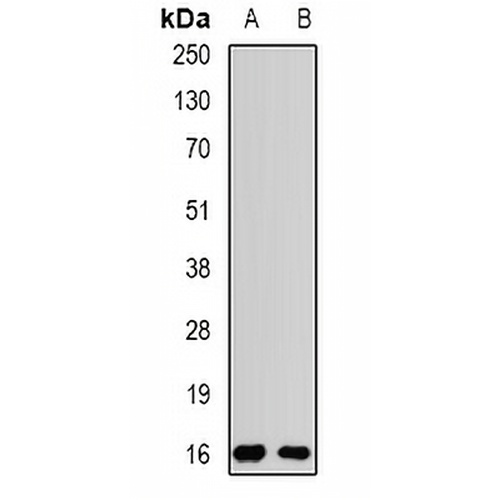 Rpp20 Rabbit Polyclonal Antibody