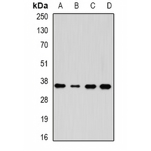 AKR7A3 Rabbit Polyclonal Antibody