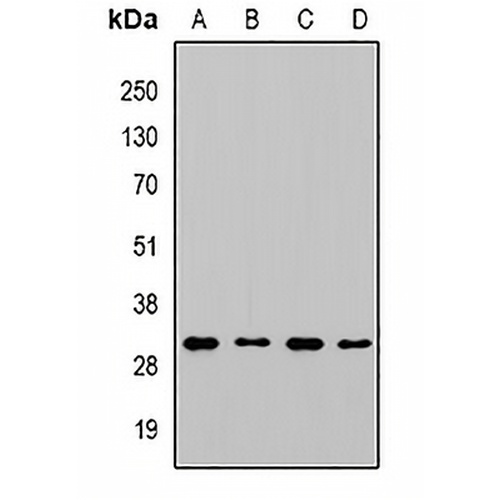 CHMP1B Rabbit Polyclonal Antibody