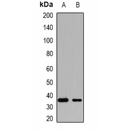 KCTD15 Rabbit Polyclonal Antibody