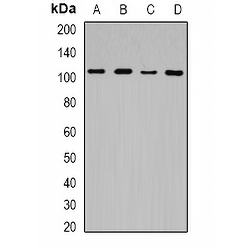 JHDM1D Rabbit Polyclonal Antibody