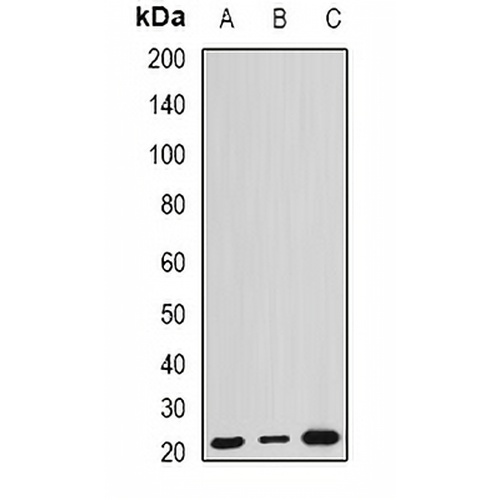 ARL6 Rabbit Polyclonal Antibody