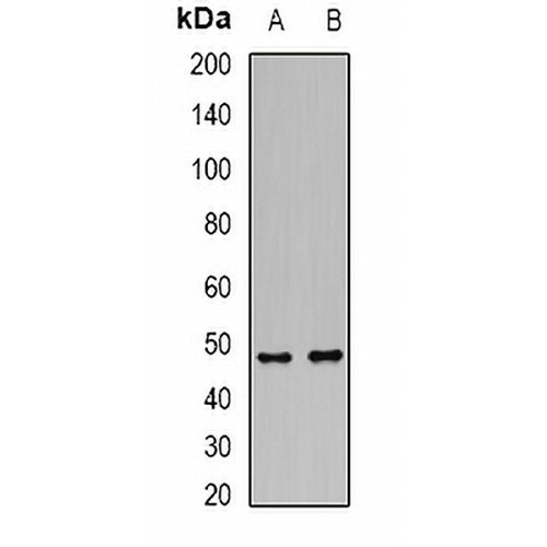 DCP2 Rabbit Polyclonal Antibody