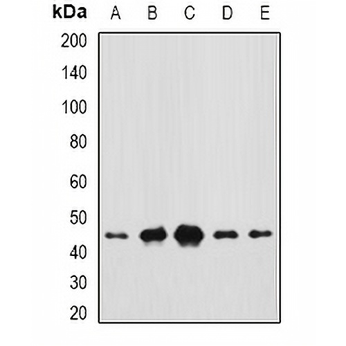 CEP44 Rabbit Polyclonal Antibody