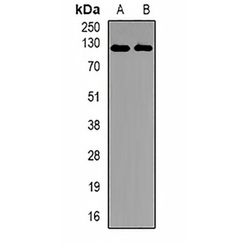 EPHA4 Rabbit Polyclonal Antibody