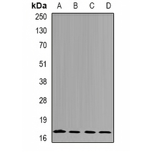 nm23-H4 Rabbit Polyclonal Antibody