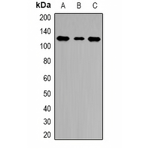 HLTF Rabbit Polyclonal Antibody