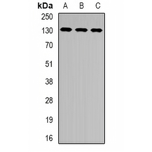 XPC Rabbit Polyclonal Antibody
