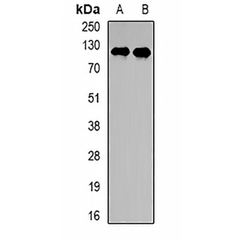 PPP6R2 Rabbit Polyclonal Antibody