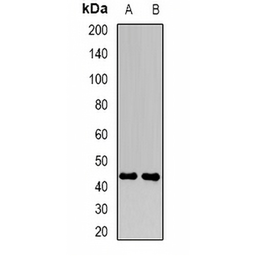 FBXO22 Rabbit Polyclonal Antibody
