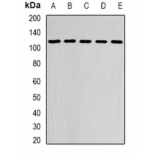 DHTKD1 Rabbit Polyclonal Antibody