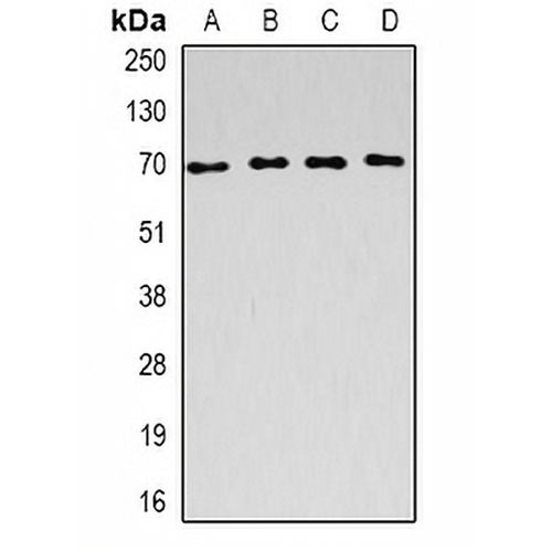 ACADVL Rabbit Polyclonal Antibody
