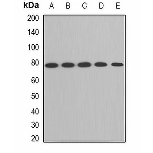 ACAS2 Rabbit Polyclonal Antibody
