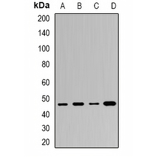 BAF53B Rabbit Polyclonal Antibody