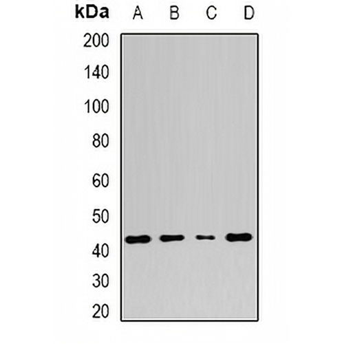 Adenosine Deaminase Rabbit Polyclonal Antibody