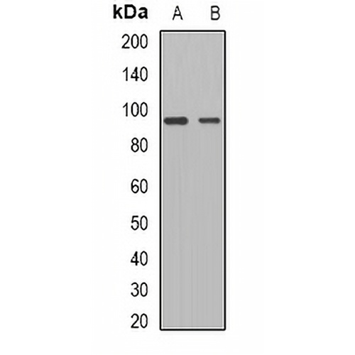 ADAM15 Rabbit Polyclonal Antibody