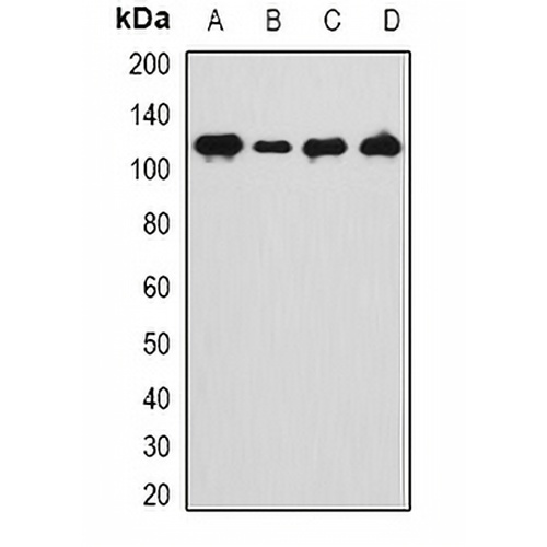 ANKRD28 Rabbit Polyclonal Antibody