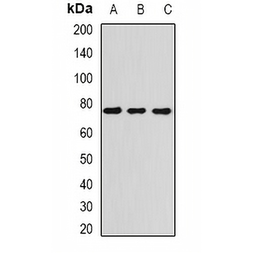 ATR Rabbit Polyclonal Antibody